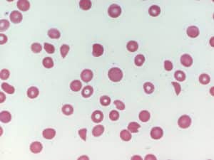 blood cells